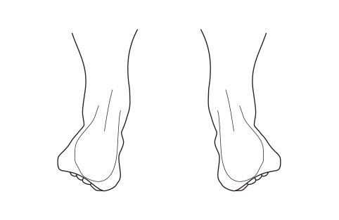 Pronated feet