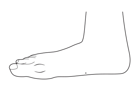 Weight bearing (the dot represents previous arch apex position)